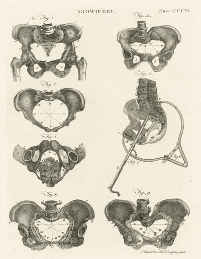 Obstétrique, illustration de 